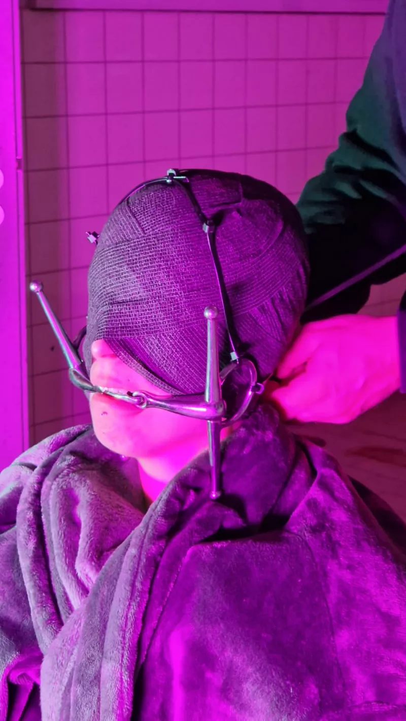 Close-up of a person with head wrapped in bandages and metallic apparatus